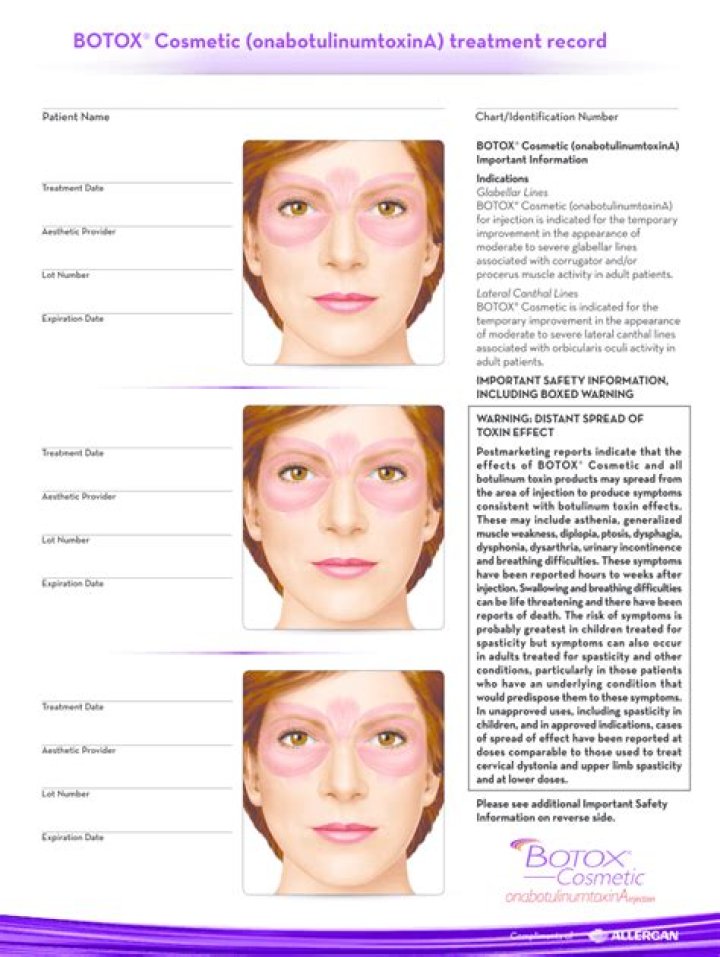 Botox Information Sheet PDF: Complete Guide & Key Details