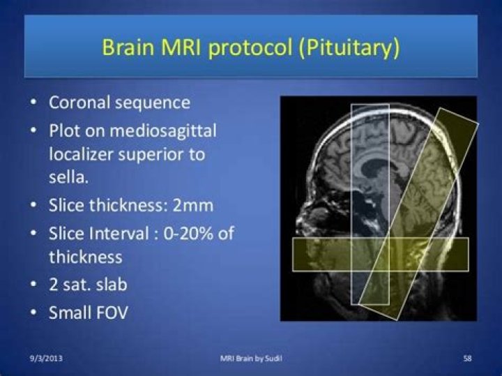 Brain MRI Protocols and Planning PDF Guide