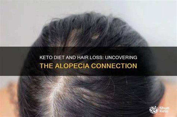 Can alopecia be cured by diet?