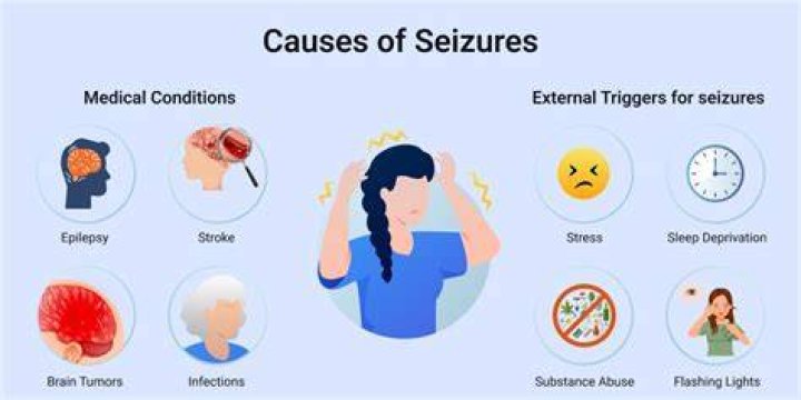 Can desmopressin cause seizures?