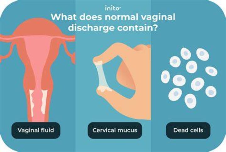 Can elderly women have vaginal discharge?
