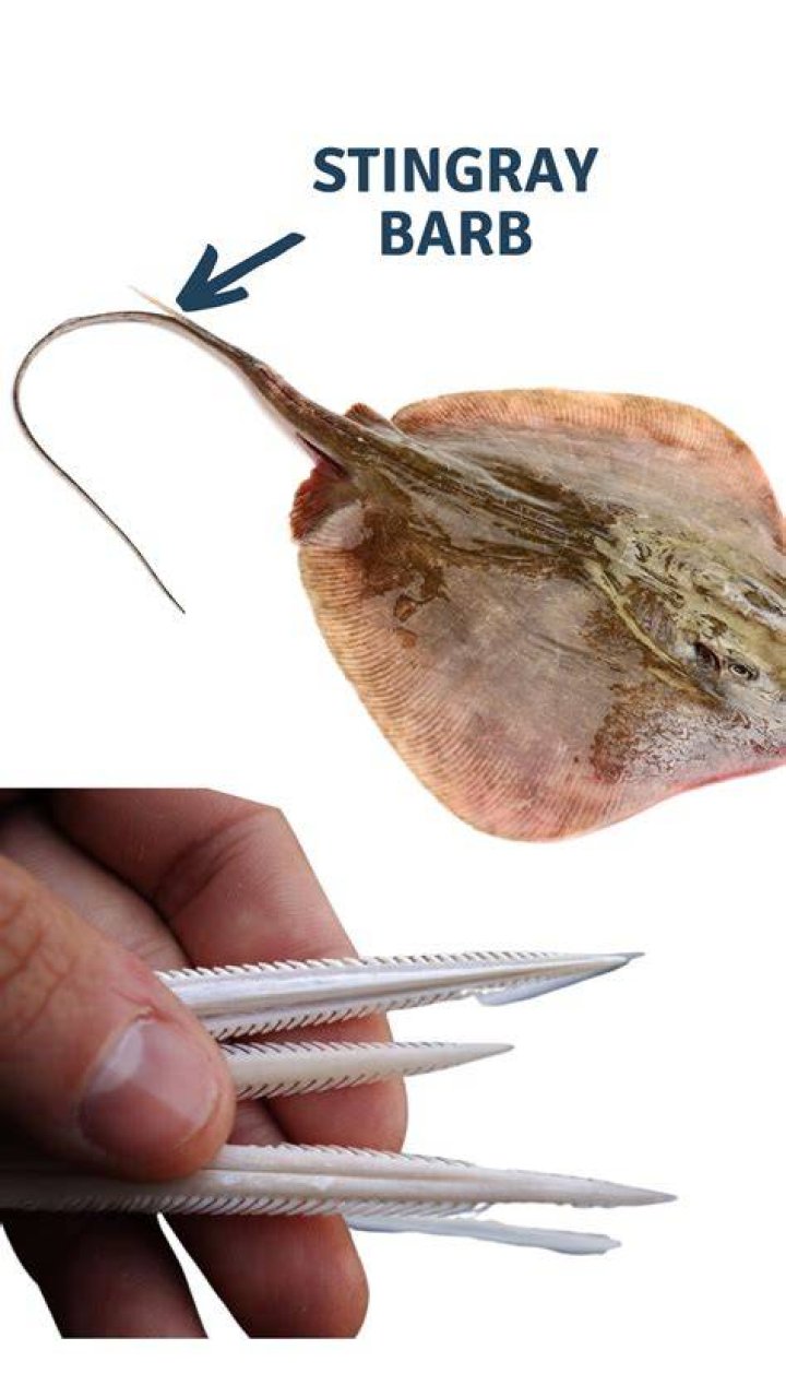 Can you survive a stingray sting?