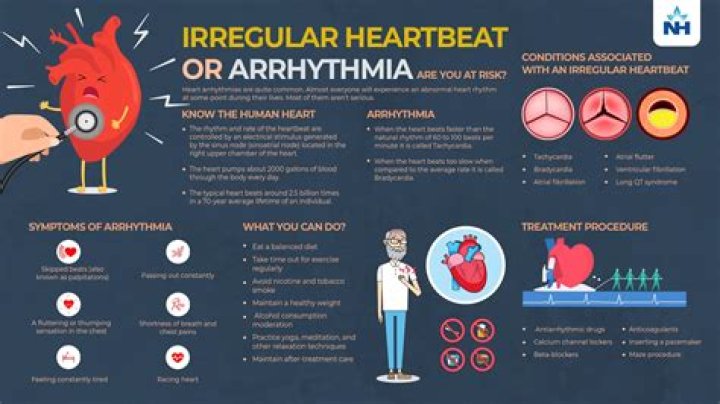Understanding Cardiac Arrhythmia: Mechanisms, Diagnosis, and Management PDF