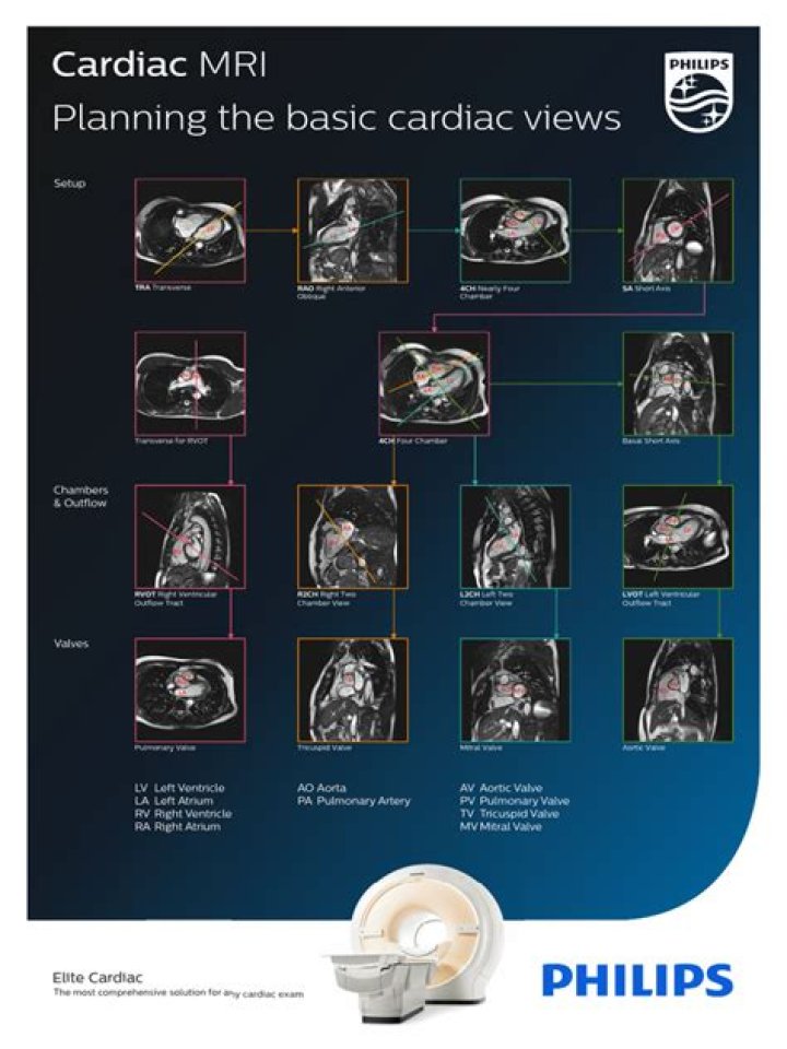 Cardiac MRI Planning PDF: Essential Guide for Accurate Heart Imaging