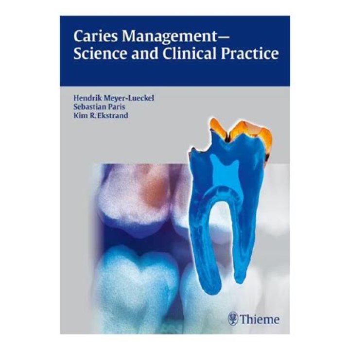 Caries Management Science and Clinical Practice: Essential PDF Guide