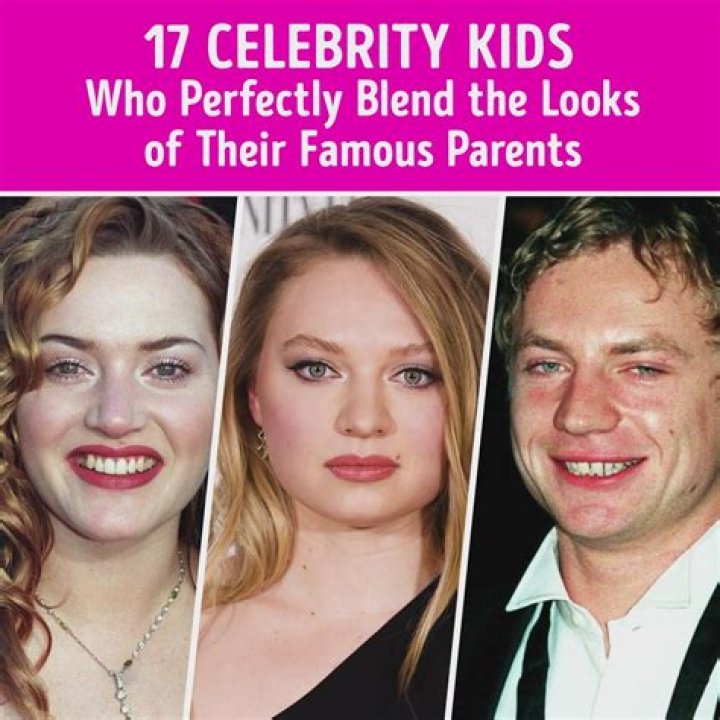 Celebrity Parents Of Children With Down Syndrome The Clooney Twins