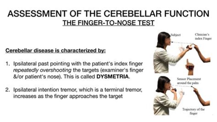 Cerebellar Function Test PDF: Accurate Assessment of Coordination & Balance