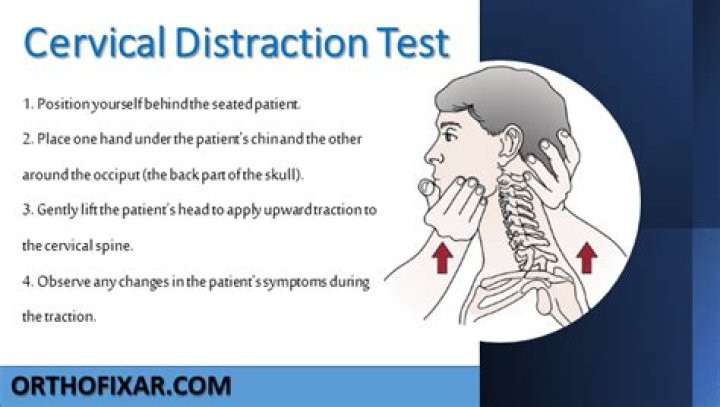 Cervical Spine Special Tests PDF: Essential Clinical Evaluation Guide