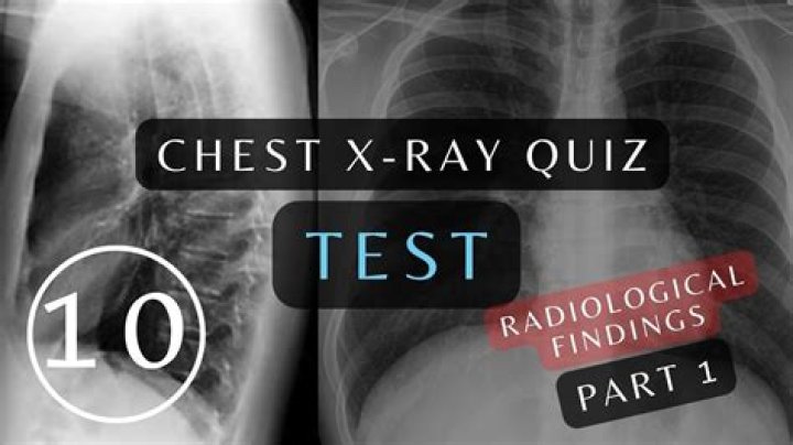 Chest X-Ray Questions & Answers PDF: Expert Guide to Interpretation
