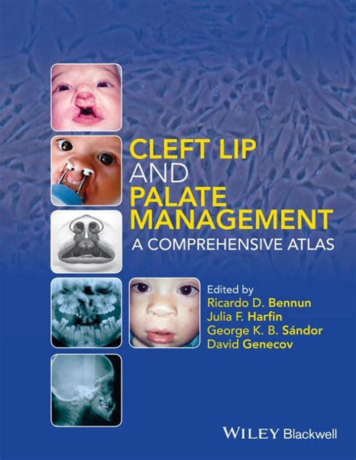 Cleft Lip and Palate Management: Comprehensive Atlas PDF Guide