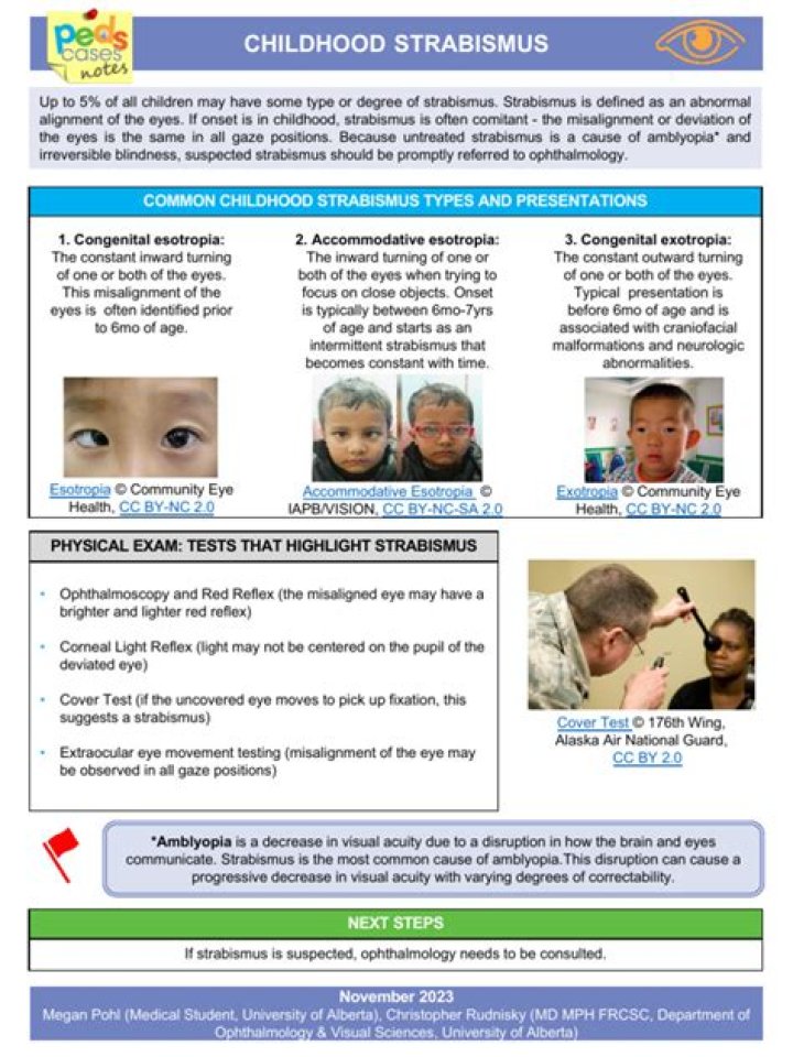 Comprehensive Guide to Clinical Management of Strabismus: Expert PDF Resources