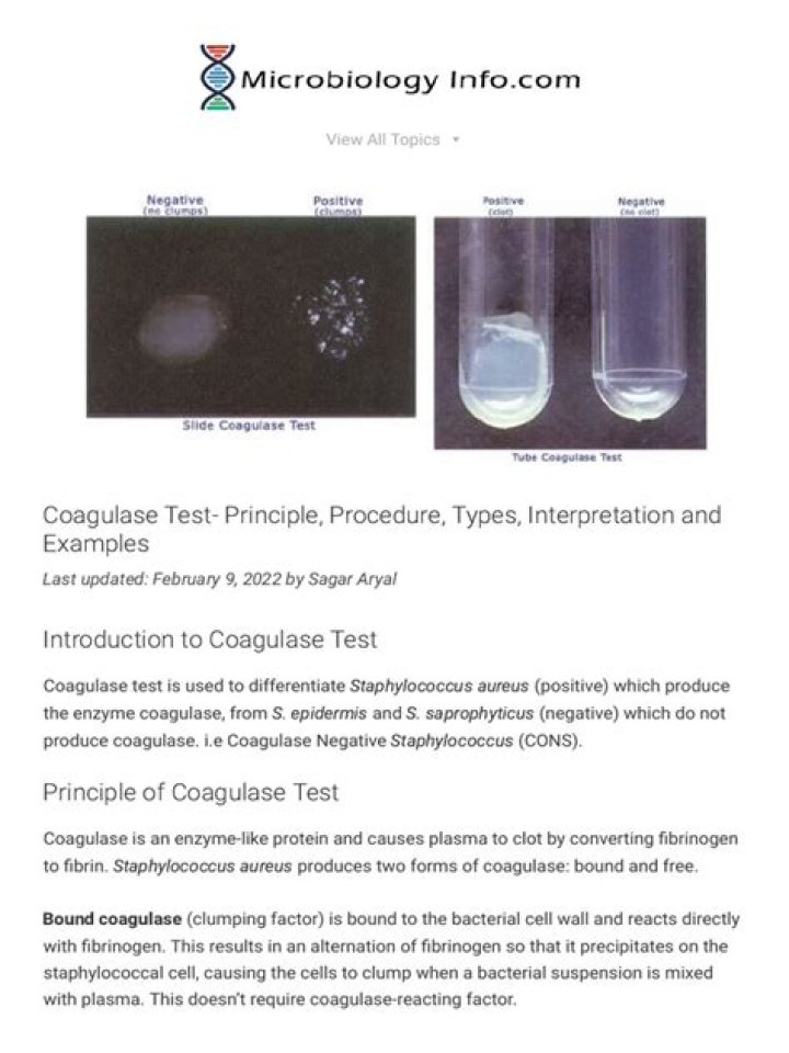 Coagulase Test Procedure PDF: Step-by-Step Laboratory Guide