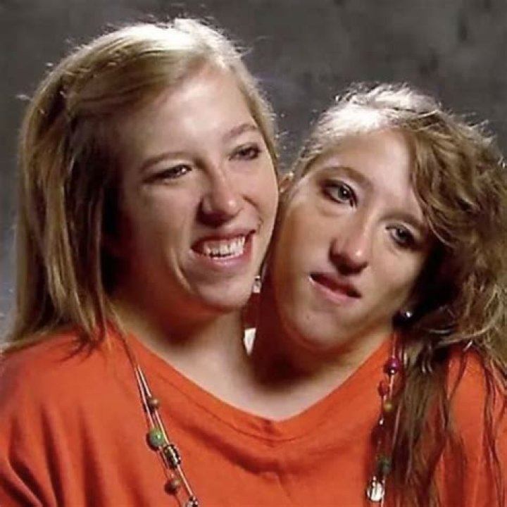 Conjoined twins Abigail and Brittany Hensel take in the sights of