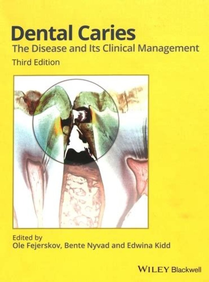 Dental Caries: Understanding the Disease and Evidence-Based Clinical Management PDF