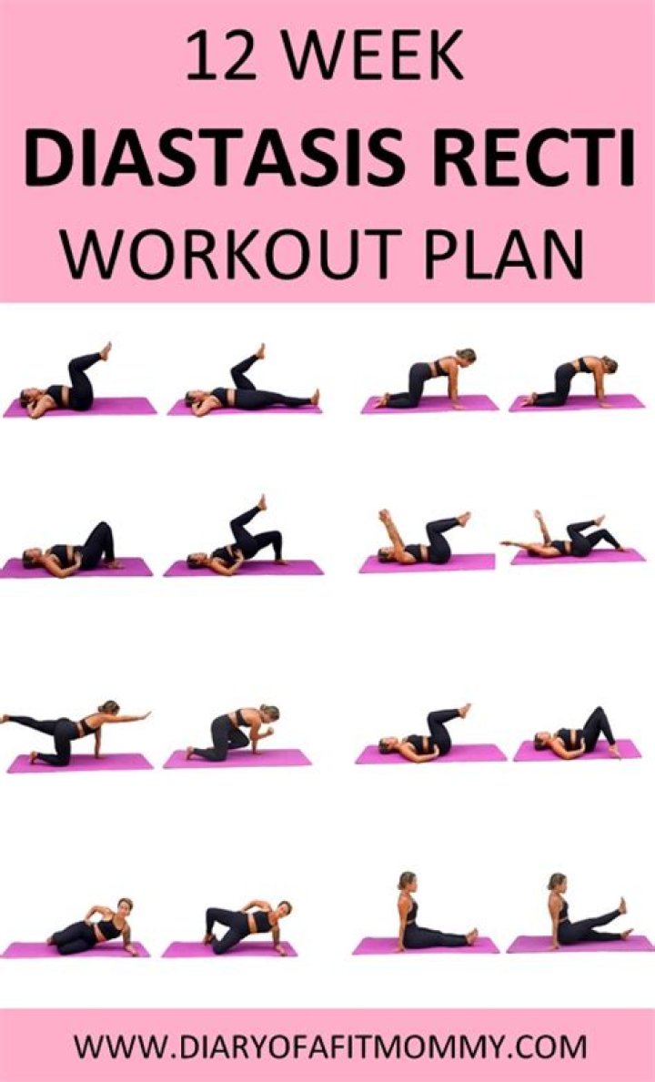Diastasis Recti Workout Plan PDF – Safe & Effective Exercises