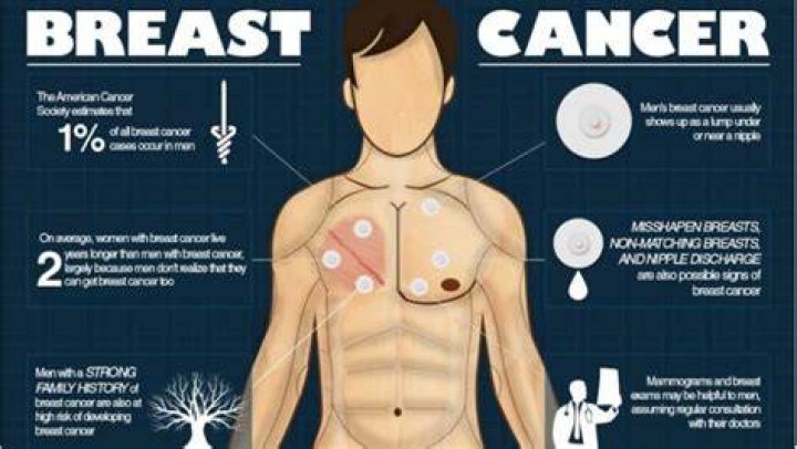 Do men have breast?