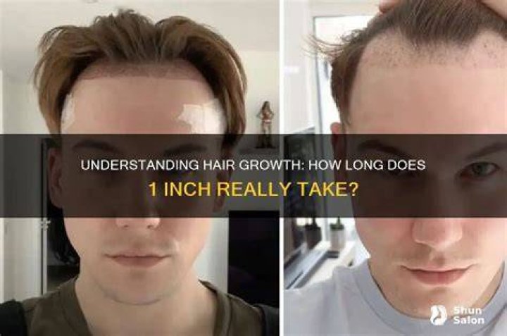 Do some people grow an inch of hair a month?