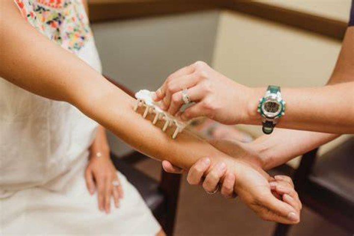 Do you have to take a skin test at your hairdresser?