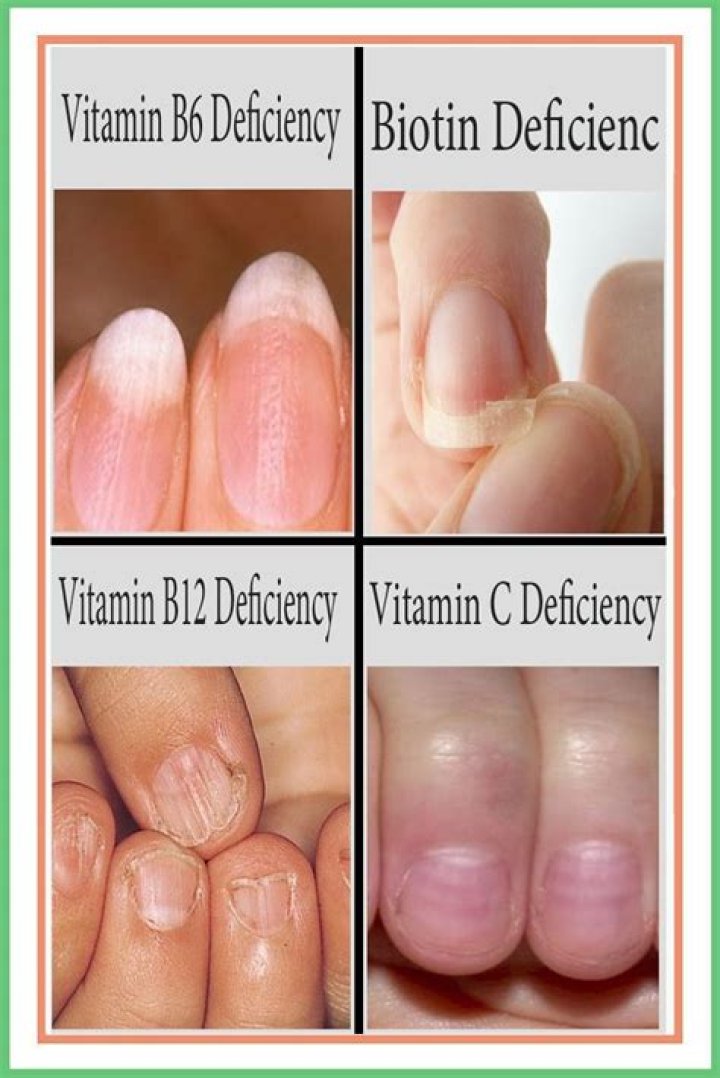 Does B12 make your nails grow?