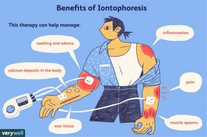 Does iontophoresis work for tendonitis?