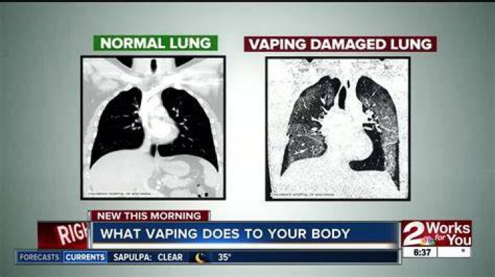 Does vaping make pneumonia worse?