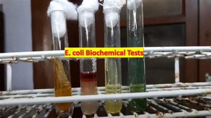 Complete E. coli Biochemical Tests PDF Guide: Accurate Lab Analysis