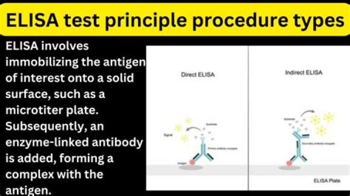 Elisa Test: Complete Principle and Procedure PDF Guide