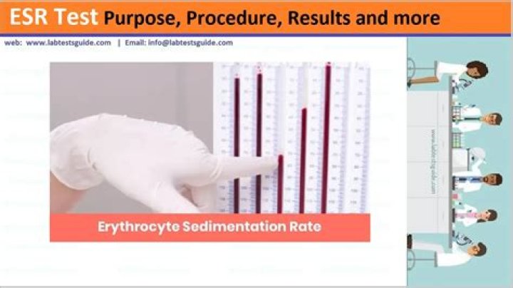 Complete ESR Test Procedure PDF: Step-by-Step Guide