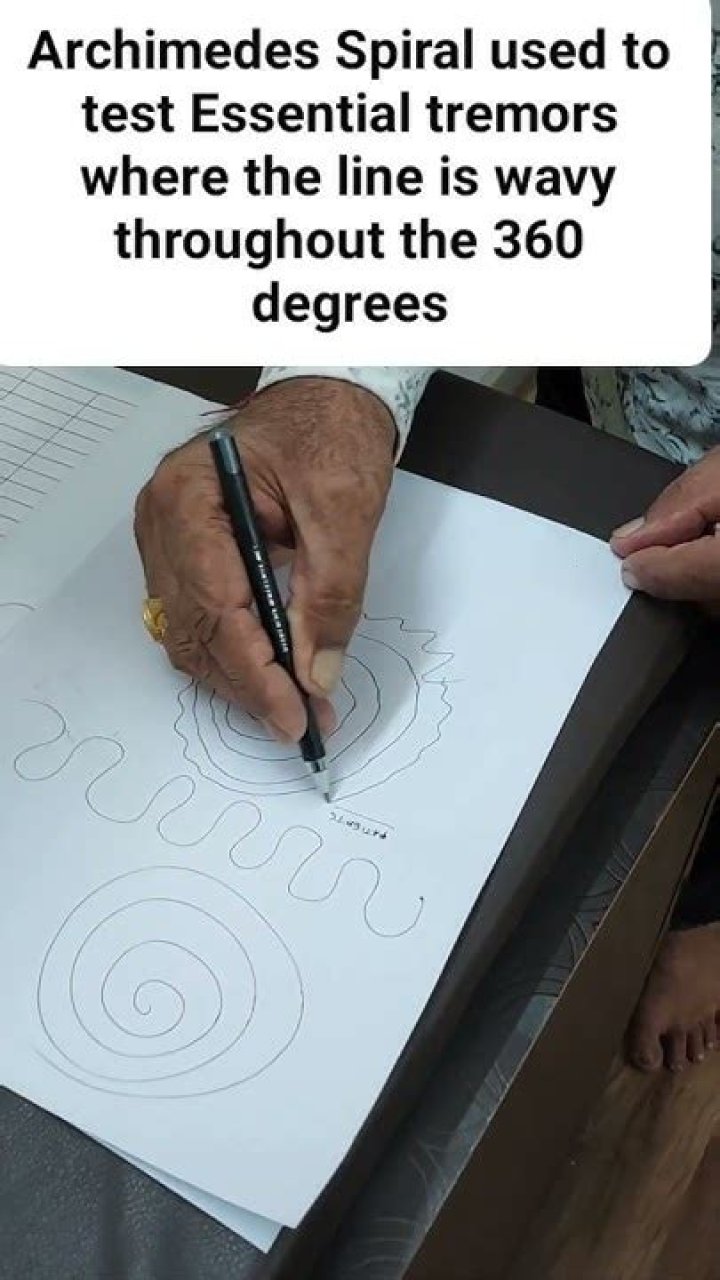 Essential Tremor Spiral Test PDF: Diagnosis & Diagnosis Guide