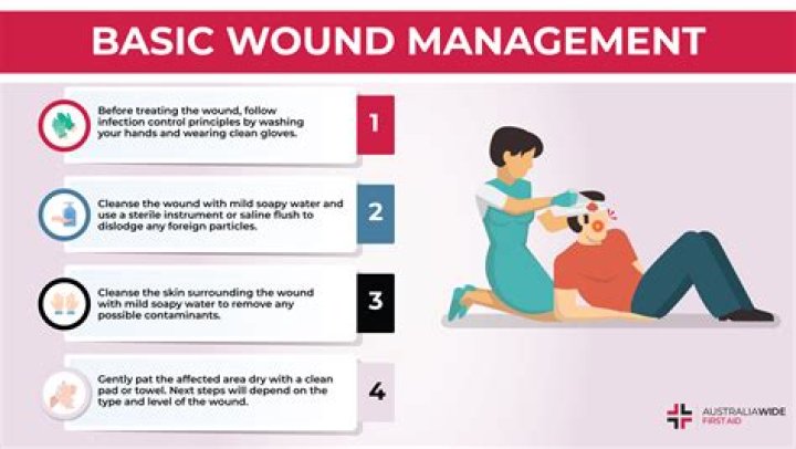 First Aid Management of Fracture PDF: Essential Steps to Save Lives