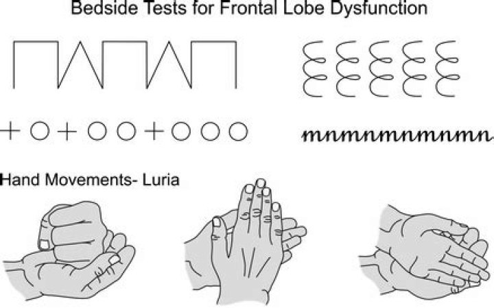 Frontal Lobe Testing PDF: Essential Diagnostic Guide