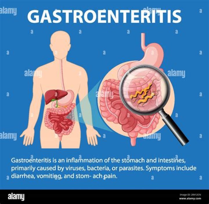 Gastroenteritis