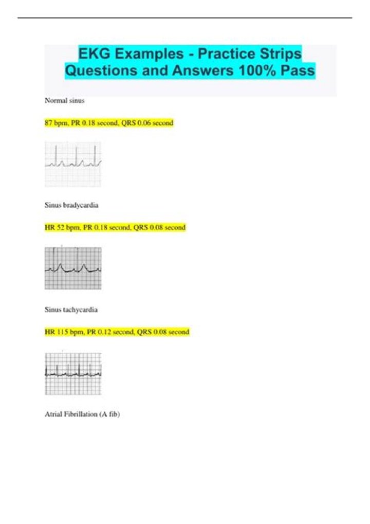 HealthStream EKG Test Answers PDF – Instant Access to Accurate Results