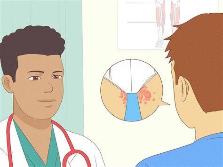 How do I get rid of a rash between my legs?
