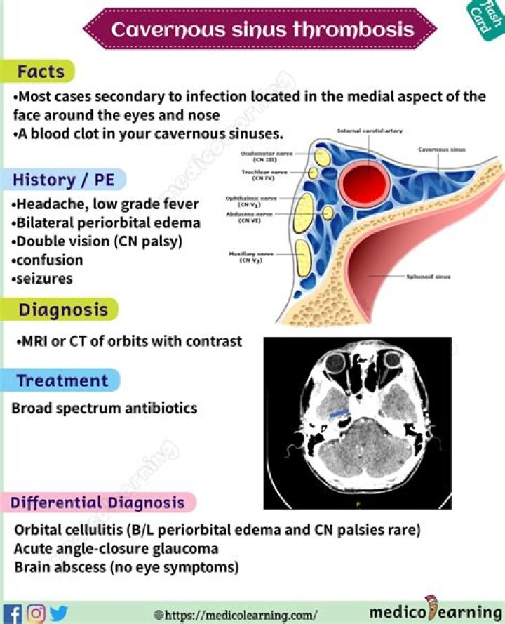 How do you evaluate cavernous sinus thrombosis?