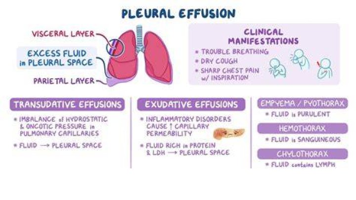 How does pneumonia cause parapneumonic effusion?