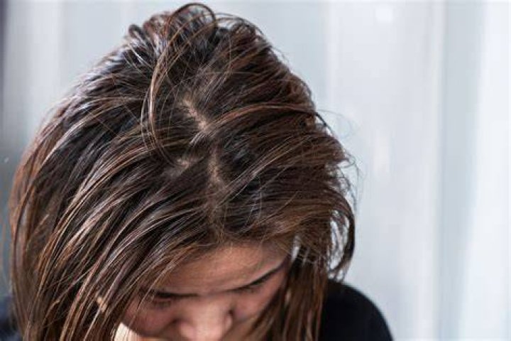 How long does it take for unwashed hair to stop being greasy?