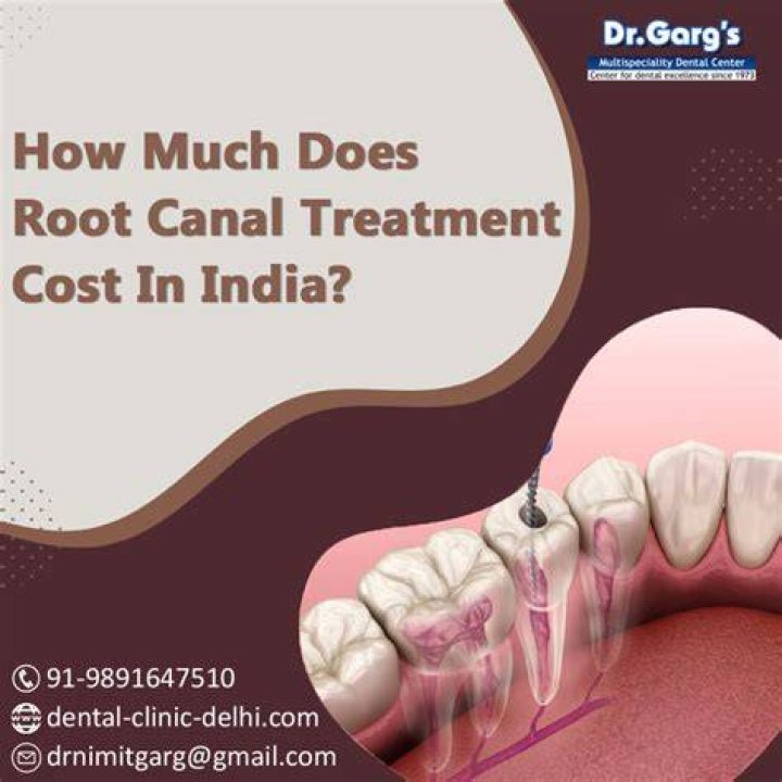 How much does root canal cost in India?