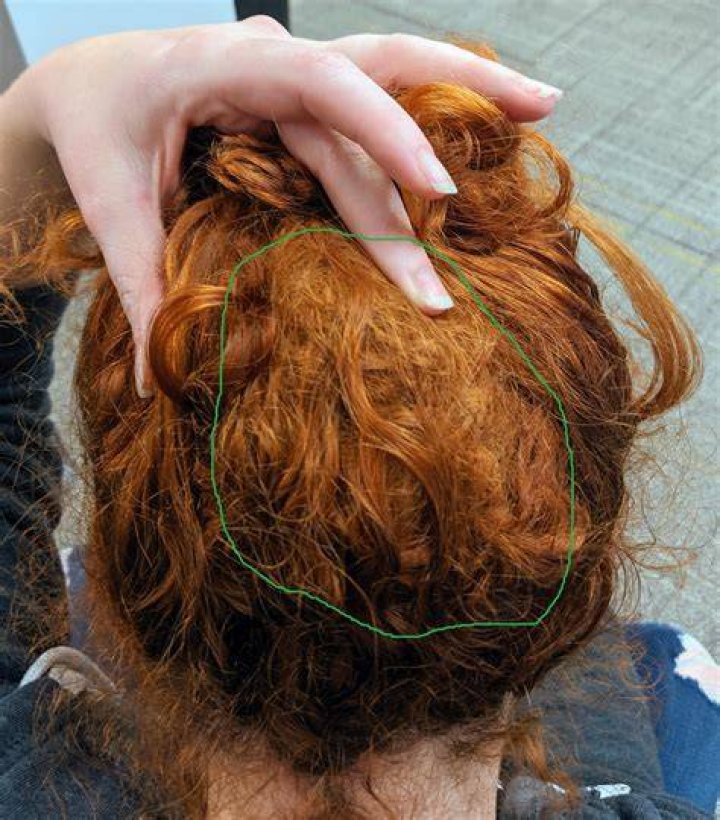 How to get a hair knot out of your hair?