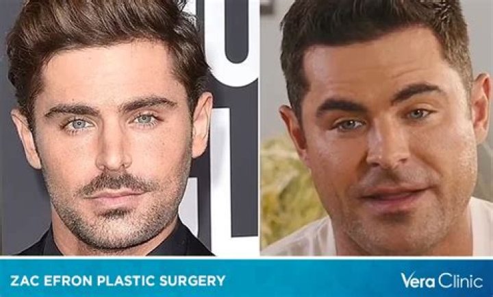 Information All About Zac Efron 2024 Daryn Emlynne