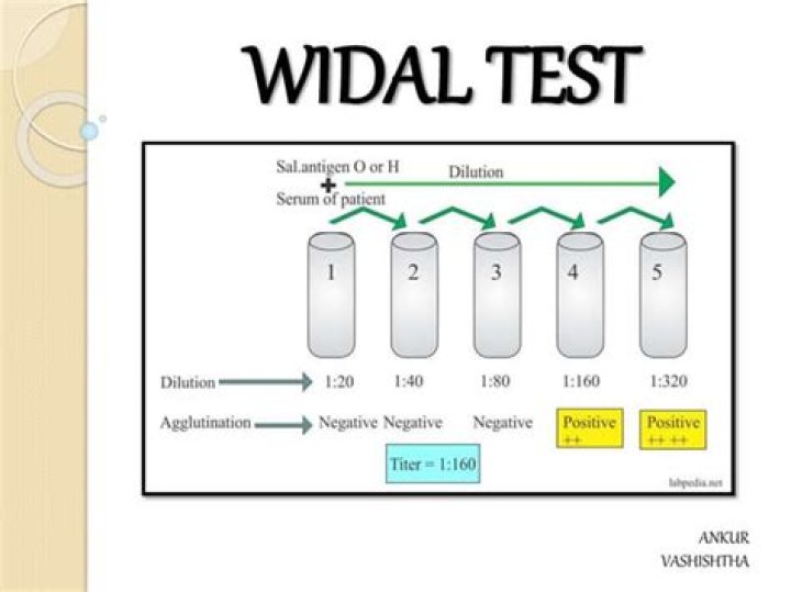 Interprétation du Test de Widal et Félix PDF : Guide Complet et Analyse Fiable