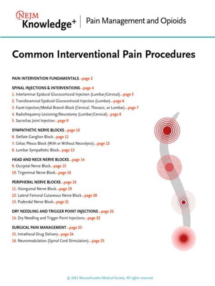 Interventional Pain Management Procedures: Expert PDF Guide