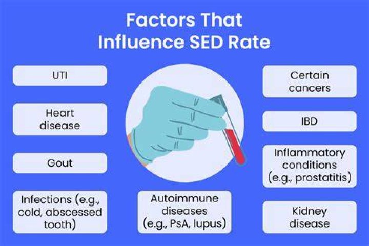 Is 2 a good sed rate?