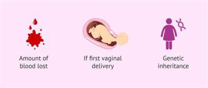 Is it normal to not have a period for a year after giving birth?