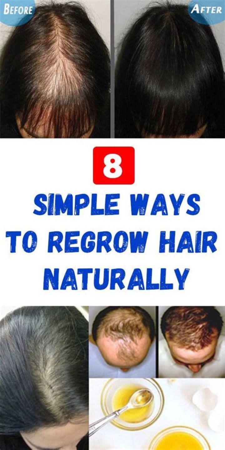 Is it possible to regrow your hair?