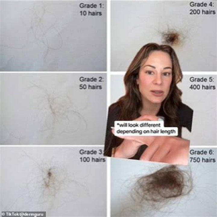 Is losing 100 hairs a day normal?