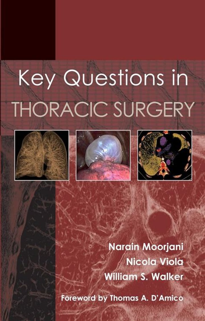 Key Questions in Thoracic Surgery: Free PDF Download