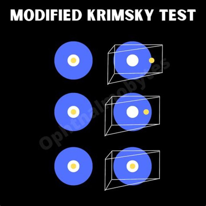 Krimsky Test PDF: Accurate Diagnosis PDF for Quick Results
