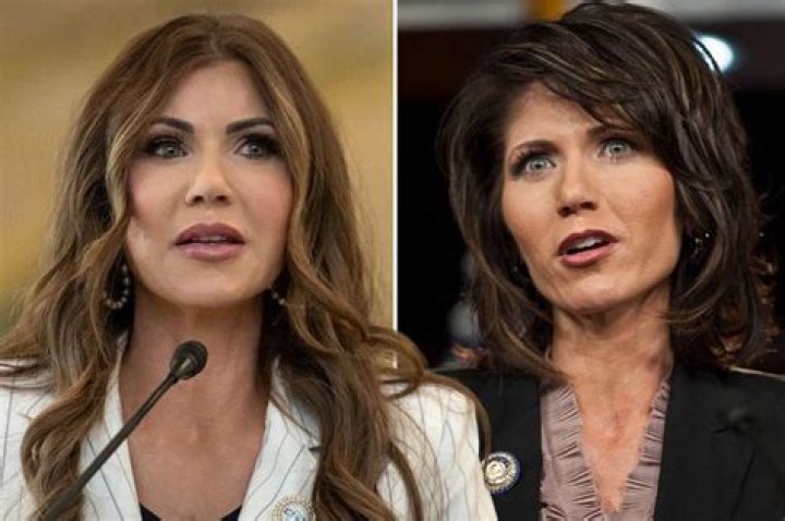 Kristi Noem Before Plastic Surgery Kristi Noem Photos Of The South