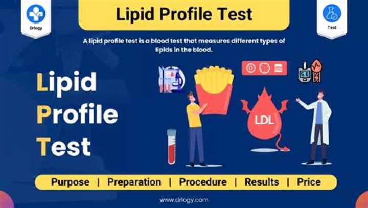 Lipid Profile Test Details PDF: Comprehensive Results & Interpretation